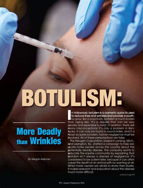 Botulism is a rare but serious illness. Horse Health-Botulism: More Deadly Than Wrinkles | MA ...