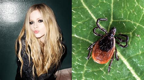 Avril Lavigne Says She Accepted Death During Battle With Lyme Disease