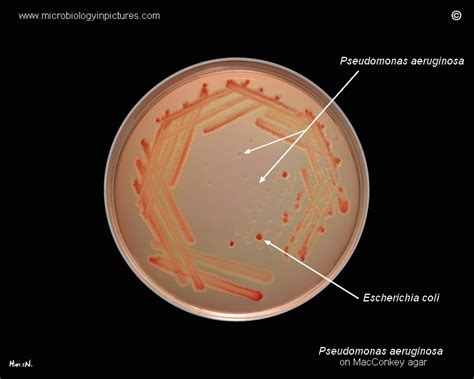 Pseudomonas Aeruginosa Colony Morphology