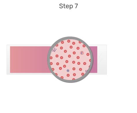 Differential Blood Test Process And Interactive Diagrams Getbodysmart