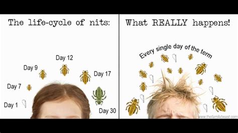 How To Get Rid Of Lice In 3 Simple Steps The Life Cycle Of Nits