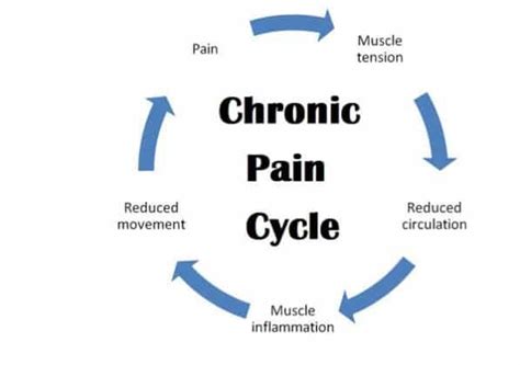 What Is Chronic Pain Syndrome Health Cart Hub