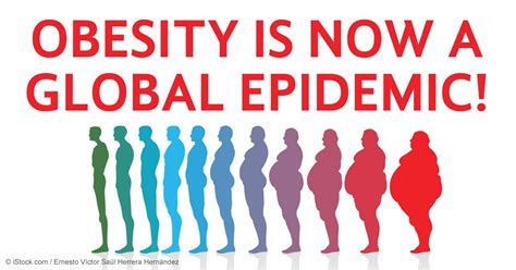 Obesity Is Now A Global Epidemic Young Professionals Chronic Disease