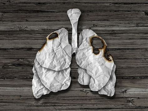 Lung Cancer Awareness Month What Makes It The Most Common