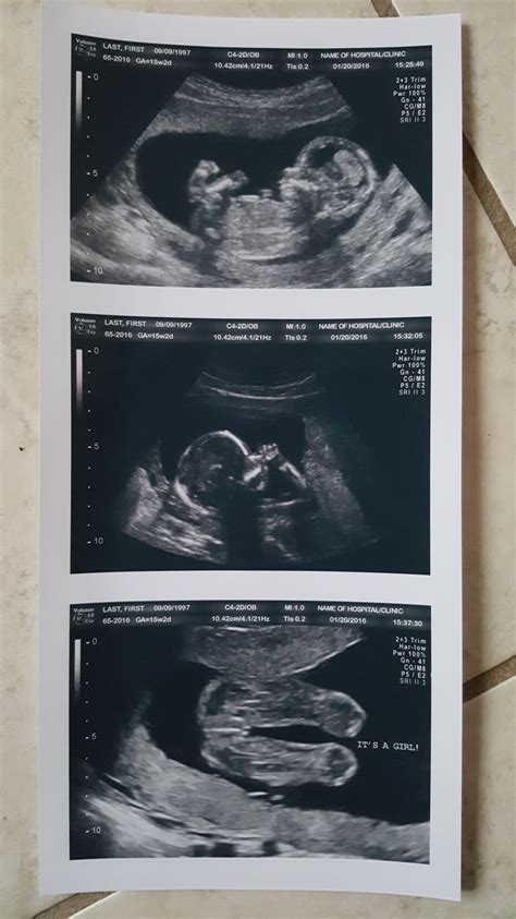 Prank Pregnancy Fake Customized 2d Ultrasound 3 Photo Strip Real Us Paper
