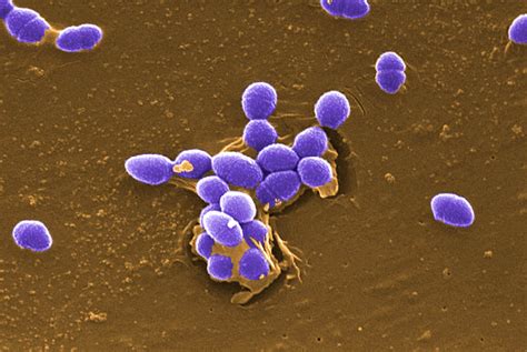 Free Picture Large Numbers Gram Positive Enterococcus Faecalis