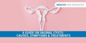 What Exactly Is Vaginal Cysts And What Are Their Types