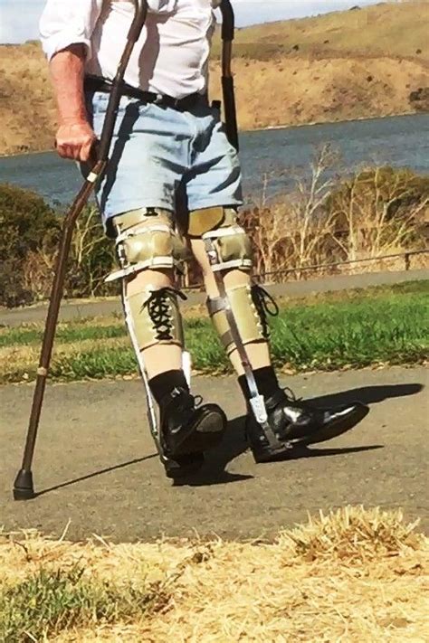 Pin By Cathyflorence On Medical Photos Leg Braces Legs