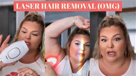 I Tried At Home Laser Hair Removal Youtube