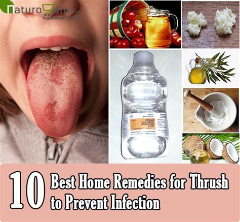 10 Best Home Remedies For Thrush To Prevent Infection Home Remedies For Thrush Home Remedies