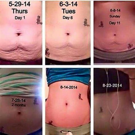 Nerium Firm Cellulite Best Weight Loss Weight Loss Tips Stretch