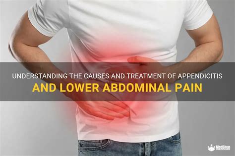 Understanding The Causes And Treatment Of Appendicitis And Lower Abdominal Pain MedShun