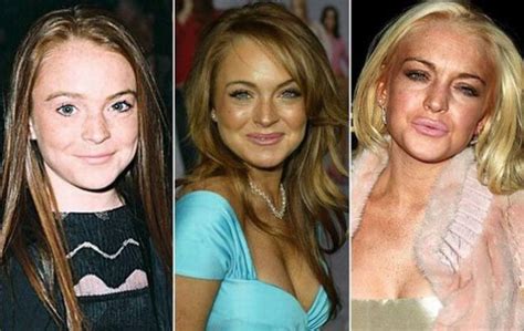 Lindsay Lohan Then Now Born Realist