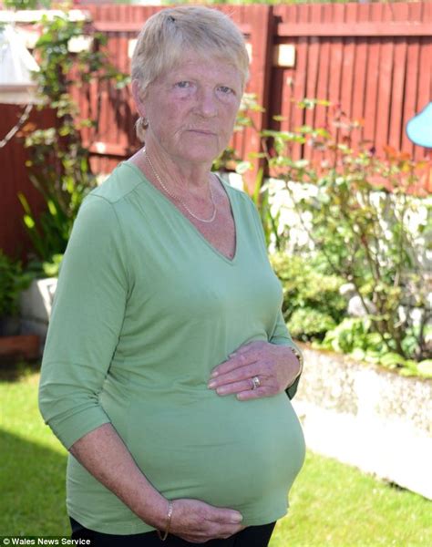 Grandmother Looks Pregnant Because Two Huge Hernias The Size Of A Sexiezpix Web Porn