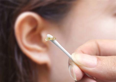 Can Ear Wax Removal Cause Bleeding