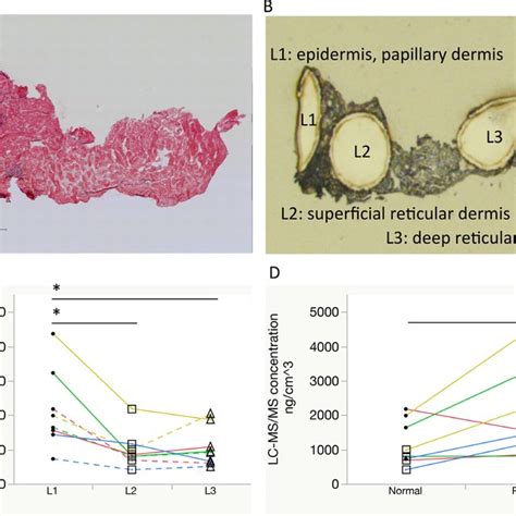 Representative Molecular Images Of Erlotinib Distribution In Skin Rash
