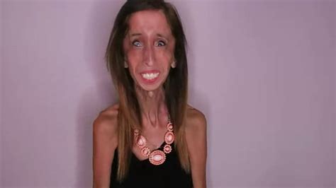 What Really Makes A Person Beautiful Lizzie Velasquez Wants To Know Glamour