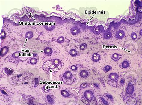 Man Scalp Transverse Section 32x Scalp Mammals Integumentary