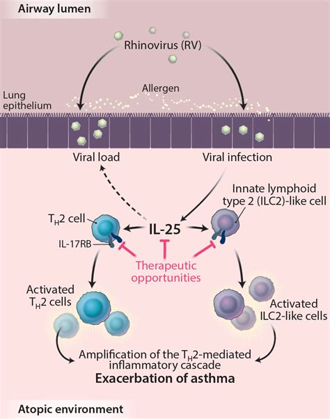 Il 25 The Missing Link Between Allergy Viral Infection And Asthma