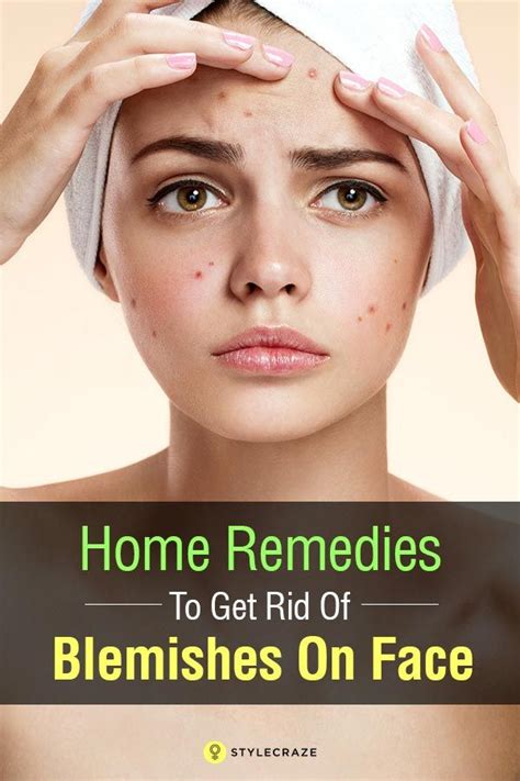 19 Best Home Remedies To Get Rid Of Blemishes On Face Blemish