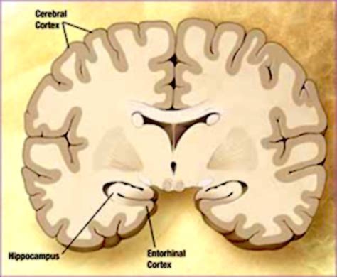 Entorhinal Cortex Failure To Listen