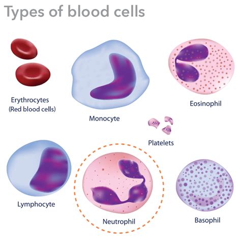 White blood cells are cellular components of blood that lack hemoglobin but possess a nucleus. Neutropenia in Children - Low Neutrophils
