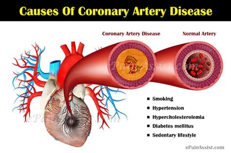 It is a medical problem that increases your risk of other diseases and health problems, such as heart disease, diabetes, high blood pressure and certain cancers. Breakdown of Coronary Heart Disease - Healthy Communities ...