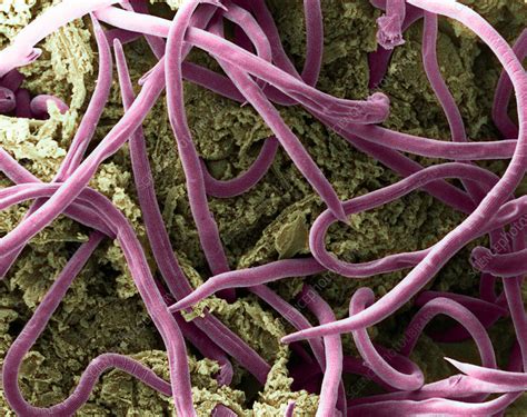 Threadworms In Intestine Sem Stock Image Z1800225 Science Photo