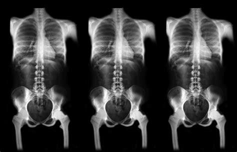 X ray cloth scan camera prank. X Ray Skeletons Halloween Costume Fabric fabric - lovelylepidoptera - Spoonflower