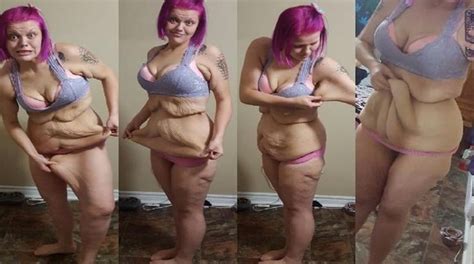 Even After Losing An Incredible Pounds This Woman Is Not Happy In