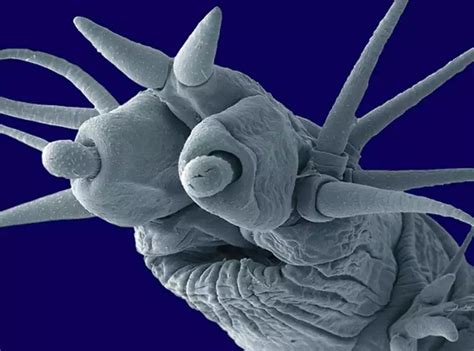 22 Things That Look Super Weird Under A Microscope