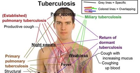The global burden of tuberculosis (tb), risk factors for transmission, and the epidemiology of tb in the united states will be reviewed here. About Health: Tuberculosis