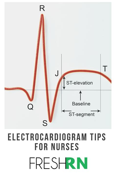 5 Lead Ecg Interpretation Electrocardiogram Tips For Nurses Ecg