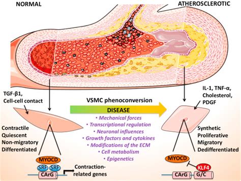 targeting the phenotypic switch of vascular smooth muscle cells to tackle atherosclerosis