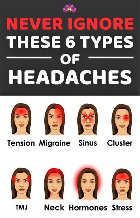 You Should Never Ignore These Six Types Of Headaches Types Of Headaches Headache Types