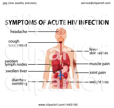 Many will experience severe the inflammatory response generated by your besieged immune system can cause you to feel tired and lethargic. Clipart of a Medical Diagram of Symptoms of Acute HIV ...