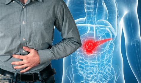 Stomach Pain Bloating Causes Can Include Pancreatic Cancer Symptoms And Signs Express Co Uk