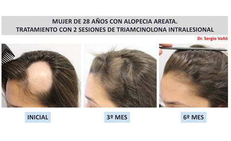 Ethical Consumer Causas De La Alopecia