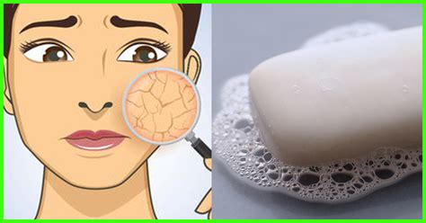 these 9 signs tell you that your soap doesn t suitable for your face health 24 life