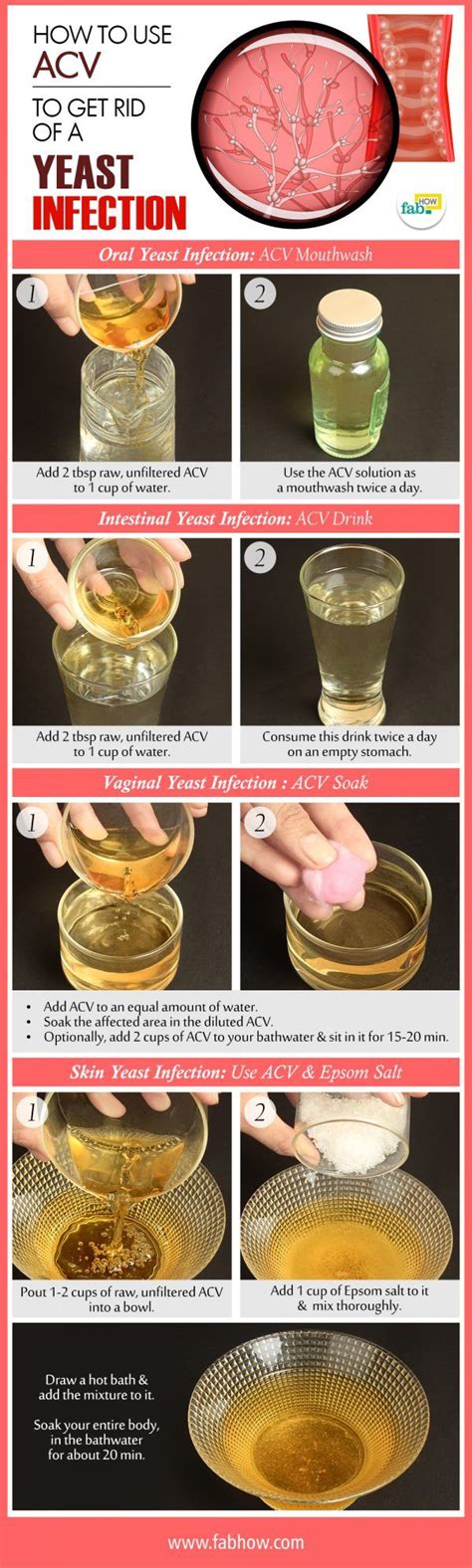 How To Use Apple Cider Vinegar To Get Rid Of A Yeast Infection