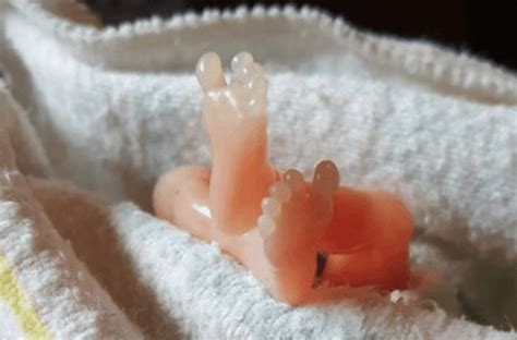 Mom Posts Photos Of Her Beautiful Child Miscarried At 14 Weeks Now