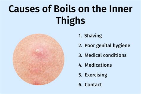 What Causes Multiple Boils On The Body Boils Better Health Channel