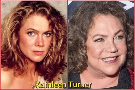 Kathleen Turner Kathleen Turner Celebrities Before And After Stars