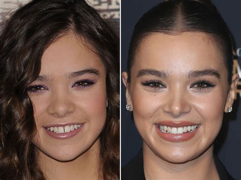Hailee Steinfeld Before And After From 2010 To 2021 The Skincare Edit