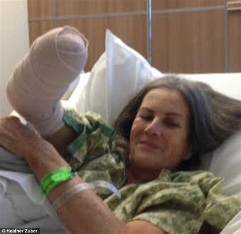 Oregon Woman Has Hand And Part Of Arm Amputated After It Was Caught In