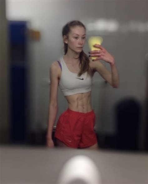 Anorexia Survivor Goes From St To Bodybuilder And Now Exposes Trolls Who Brand Her Muscles As