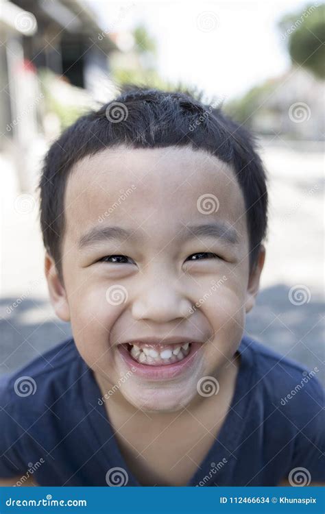 Close Up Face Of Asian Boy With Funny Milk Tooth Stock Photo Image Of