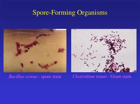Ppt Classification Of Bacteria Powerpoint Presentation Id6490953