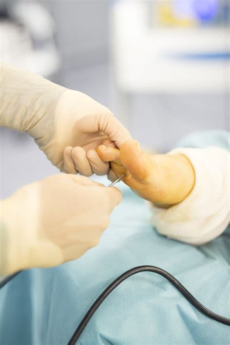 Chirurgie percutanée Centre du pied