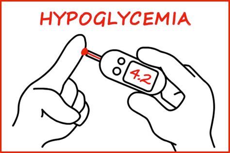 Hypoglycemia Low Blood Glucose Its Symptoms Causes Treatment